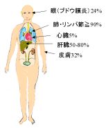 各臓器の発生頻度